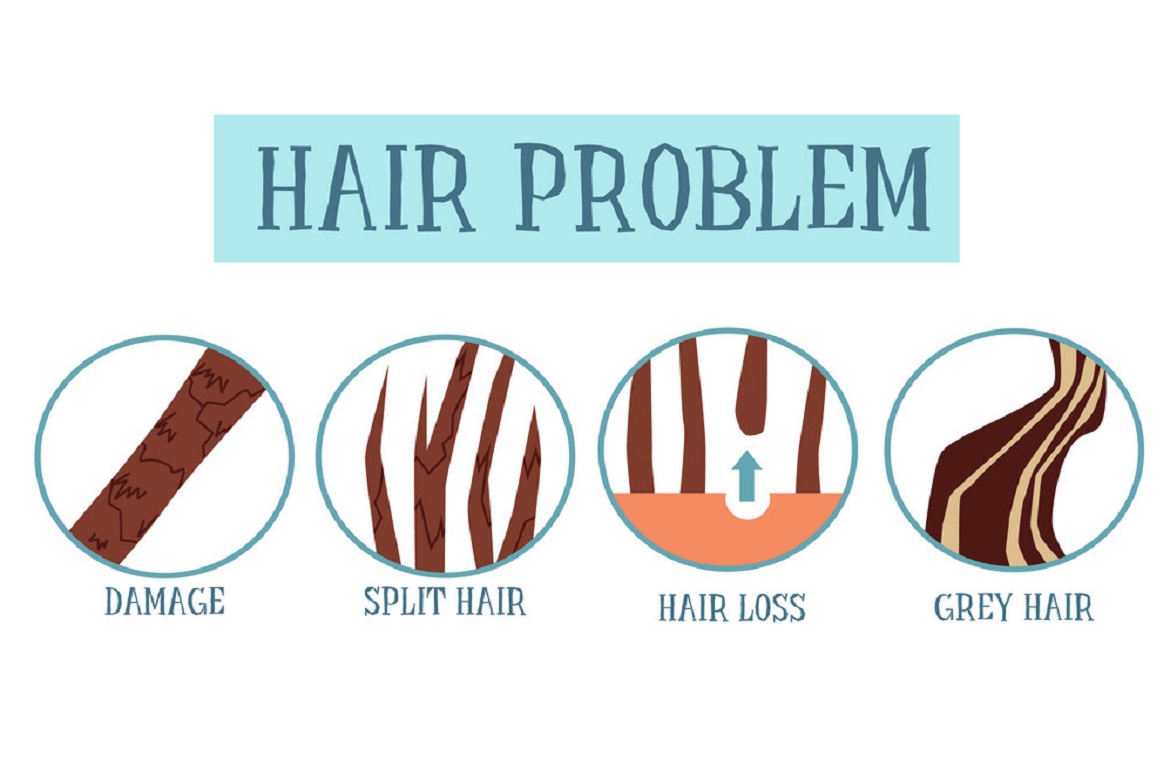 How Laser Caps Can Fight Against Thinning Hair